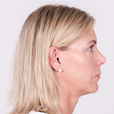 hearing aid