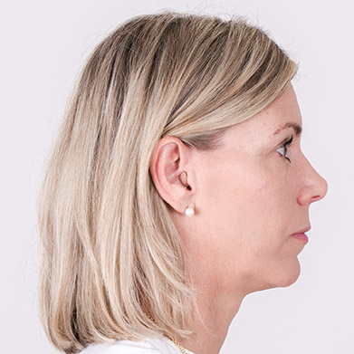 hearing aid