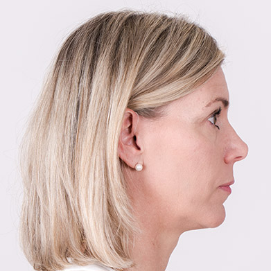 hearing aid